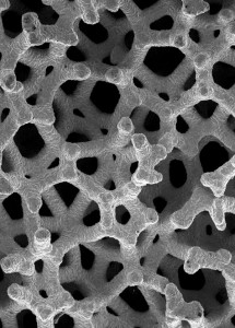 Figura 1 - Struttura trabecolare del tantalio in microscopia elettronica